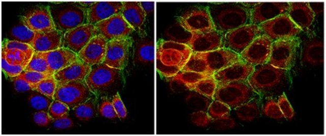 Anti-phospho-p70 S6 Kinase (Thr389) Antibody, clone 10G7.1 clone 10G7.1, from mouse