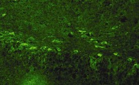 Anti-Nerve Growth Factor Antibody, pro serum, Chemicon&#174;