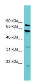 Anti-CPT1B antibody produced in rabbit affinity isolated antibody