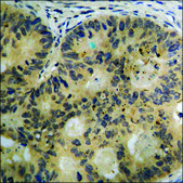Anti-phospho-ZAP-70 (pTyr493) antibody produced in rabbit affinity isolated antibody