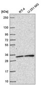 Anti-SNAP29 antibody produced in rabbit Prestige Antibodies&#174; Powered by Atlas Antibodies, affinity isolated antibody