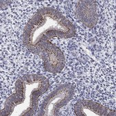 Anti-ST6GALNAC1 antibody produced in rabbit Prestige Antibodies&#174; Powered by Atlas Antibodies, affinity isolated antibody, buffered aqueous glycerol solution
