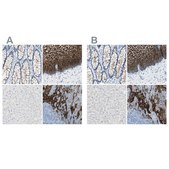 Anti-DSC2 antibody produced in rabbit Prestige Antibodies&#174; Powered by Atlas Antibodies, affinity isolated antibody, buffered aqueous glycerol solution