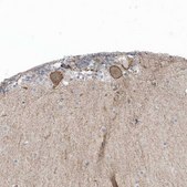 Anti-CACNB2 antibody produced in rabbit Prestige Antibodies® Powered by Atlas Antibodies, affinity isolated antibody, buffered aqueous glycerol solution