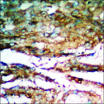 Anti-phospho-Smad3 (pSer204) antibody produced in rabbit affinity isolated antibody