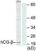 Anti-HCG &#946; antibody produced in rabbit affinity isolated antibody