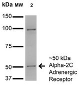 Monoclonal Anti-Versican - Hrp antibody produced in mouse clone S351-23, purified immunoglobulin