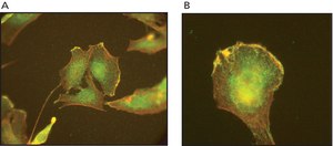 Anti-ARP3 antibody, Mouse monoclonal clone FMS338, purified from hybridoma cell culture