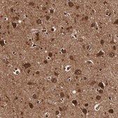 Anti-TECPR2 antibody produced in rabbit Prestige Antibodies&#174; Powered by Atlas Antibodies, affinity isolated antibody, buffered aqueous glycerol solution