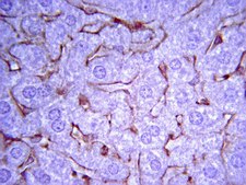 Anti-Collagen Antibody, Type IV Chemicon&#174;, from rabbit