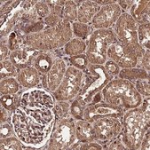 Anti-PDE4D antibody produced in rabbit Prestige Antibodies® Powered by Atlas Antibodies, affinity isolated antibody, buffered aqueous glycerol solution