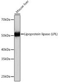 Anti-Lipoprotein lipase (LPL) Antibody, clone 10E10P9, Rabbit Monoclonal