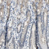 Anti-OCLN antibody produced in rabbit Prestige Antibodies&#174; Powered by Atlas Antibodies, affinity isolated antibody, buffered aqueous glycerol solution