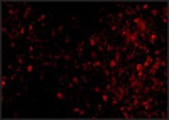 Anti-TRPC6 (ab1) antibody produced in rabbit affinity isolated antibody, buffered aqueous solution