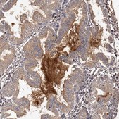 Anti-CTGF antibody produced in rabbit Prestige Antibodies&#174; Powered by Atlas Antibodies, affinity isolated antibody, buffered aqueous glycerol solution, ab2
