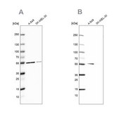 Anti-GPI antibody produced in rabbit Prestige Antibodies® Powered by Atlas Antibodies, affinity isolated antibody, buffered aqueous glycerol solution