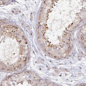 Anti-NIN antibody produced in rabbit Prestige Antibodies&#174; Powered by Atlas Antibodies, affinity isolated antibody, buffered aqueous glycerol solution