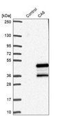 Anti-CA6 antibody produced in rabbit Prestige Antibodies® Powered by Atlas Antibodies, affinity isolated antibody, buffered aqueous glycerol solution, ab1