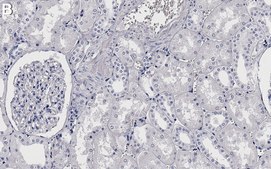 Anti-APN/CD13 Antibody, clone 1D20 ZooMAb&#174; Rabbit Monoclonal recombinant, expressed in HEK 293 cells