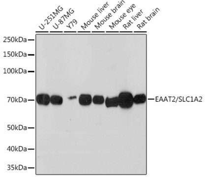 Anti-EAAT2/SLC1A2 Antibody, clone 7K5F7, Rabbit Monoclonal
