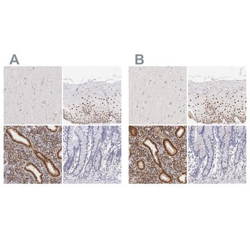 Anti-ESR1 antibody produced in rabbit Ab2, Prestige Antibodies® Powered by Atlas Antibodies, affinity isolated antibody, buffered aqueous glycerol solution