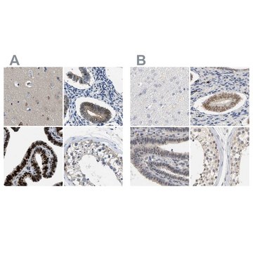 Anti-PGR antibody produced in rabbit Prestige Antibodies® Powered by Atlas Antibodies, affinity isolated antibody, buffered aqueous glycerol solution