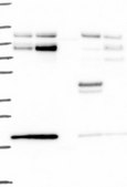 Anti-FOXK2 antibody produced in rabbit Prestige Antibodies&#174; Powered by Atlas Antibodies, affinity isolated antibody, buffered aqueous glycerol solution