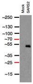Anti-SARS-CoV-1/2 NP Antibody, clone 1C7C7 ZooMAb&#174; Mouse Monoclonal recombinant, expressed in HEK 293 cells