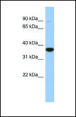 Anti-FANCL antibody produced in rabbit affinity isolated antibody