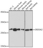 Anti-SRD5A2 antibody produced in rabbit