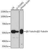 Anti-βII-Tubulin/β2-Tubulin Antibody, clone 1R3R9, Rabbit Monoclonal