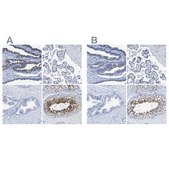 Anti-DNAI1 antibody produced in rabbit Prestige Antibodies&#174; Powered by Atlas Antibodies, affinity isolated antibody, buffered aqueous glycerol solution, Ab1