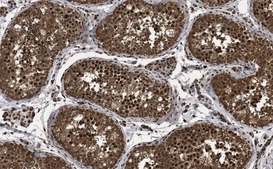 Anti-Anillin Antibody, clone 5f3.1 clone 5F3.1, from mouse