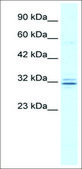 Anti-HES1 IgG fraction of antiserum