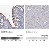 Anti-SLC9A3 antibody produced in rabbit Prestige Antibodies® Powered by Atlas Antibodies, affinity isolated antibody, buffered aqueous glycerol solution