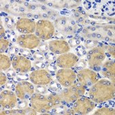 Anti- SND1 antibody produced in rabbit