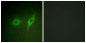 Anti-Collagen IV &#945;2 antibody produced in rabbit affinity isolated antibody