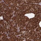 Anti-STX5 antibody produced in rabbit Prestige Antibodies&#174; Powered by Atlas Antibodies, affinity isolated antibody, buffered aqueous glycerol solution