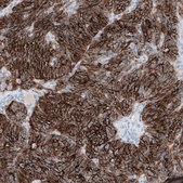 Anti-CLDN3 antibody produced in mouse Prestige Antibodies&#174; Powered by Atlas Antibodies, clone CL13128, purified by using Protein A, buffered aqueous glycerol solution