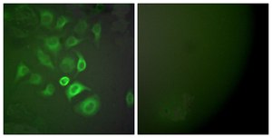 Anti-S100 A1, N-Terminal antibody produced in rabbit affinity isolated antibody