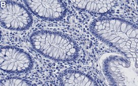 Anti-Histone H3-Lys9me3 Antibody, clone 4J8 ZooMAb&#174; Rabbit Monoclonal recombinant, expressed in HEK 293 cells