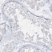 Anti-ETHE1 antibody produced in rabbit Prestige Antibodies&#174; Powered by Atlas Antibodies, affinity isolated antibody, buffered aqueous glycerol solution, ab1