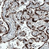 Monoclonal Anti-ATF3 antibody produced in mouse Prestige Antibodies&#174; Powered by Atlas Antibodies, clone CL1685, purified immunoglobulin, buffered aqueous glycerol solution