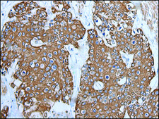 Anti-TRPC5 affinity isolated antibody