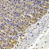 Anti-FSCN1 antibody produced in rabbit