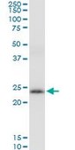 Anti-PRDX3 antibody produced in mouse purified immunoglobulin, buffered aqueous solution