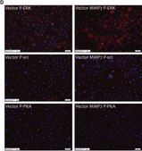 Anti-MMP-7 antibody produced in rabbit affinity isolated antibody