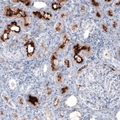 Monoclonal Anti-ACE2 antibody produced in mouse Prestige Antibodies® Powered by Atlas Antibodies, clone CL4035, purified immunoglobulin