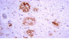 Anti-Beta-Amyloid 1-42 Antibody Chemicon&#174;, from rabbit
