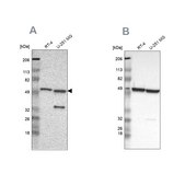 Anti-G6PD antibody produced in rabbit Prestige Antibodies&#174; Powered by Atlas Antibodies, affinity isolated antibody, buffered aqueous glycerol solution